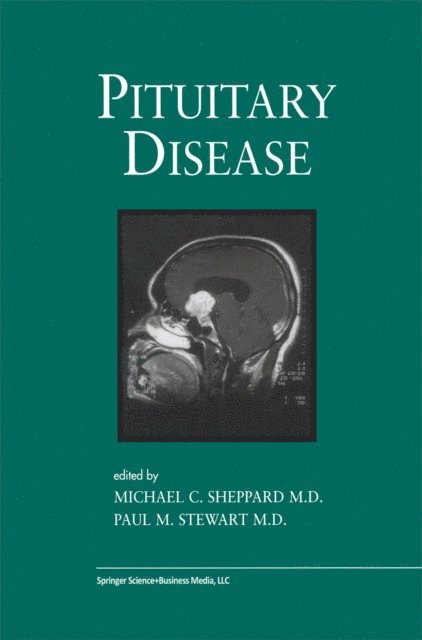 Paul M. Stewart, Michael C. Sheppard - Pituitary Disease, E-bok