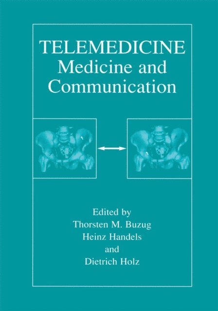 Dietrich Holz, Heinz Handels, Thorsten M. Buzug - Telemedicine, E-bok