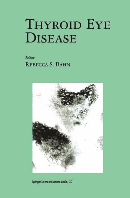 Rebecca S. Bahn - Thyroid Eye Disease, E-bok