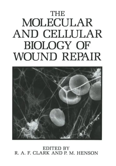 P.M. Henson, R.A.F. Clark - Molecular and Cellular Biology of Wound Repair, E-bok. Tillgänglighet: Lägg i varukorg