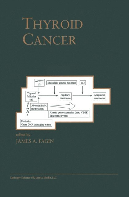 James A. Fagin - Thyroid Cancer, E-bok