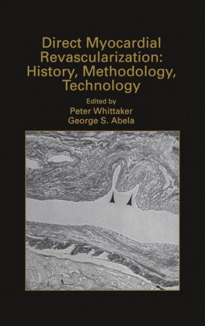George S. Abela, Peter Whittaker - Direct Myocardial Revascularization: History, Methodology, Technology, E-bok