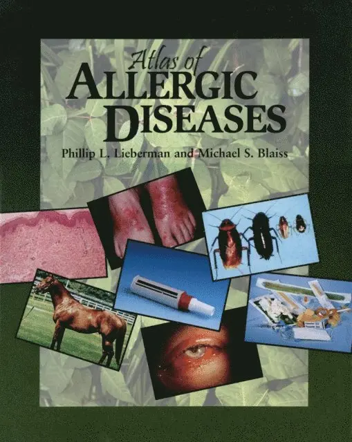 Michael Blaiss, Phillip Lieberman - Atlas of Allergic Diseases, E-bok. Tillgänglighet: Lägg i varukorg