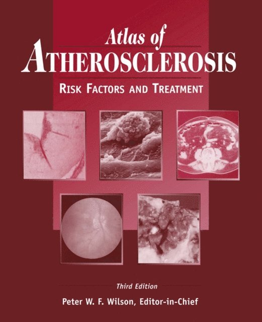 Peter W.F. Wilson - Atlas of Atherosclerosis, E-bok