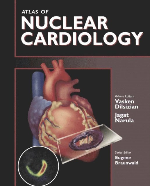 Eugene Braunwald, Jagat Narula, Vasken Dilsizian - Atlas of Nuclear Cardiology, E-bok