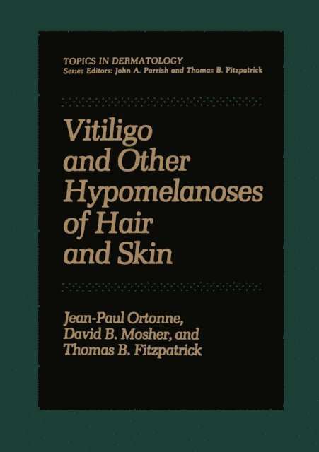 Jean-Paul Ortonne - Vitiligo and Other Hypomelanoses of Hair and Skin, E-bok