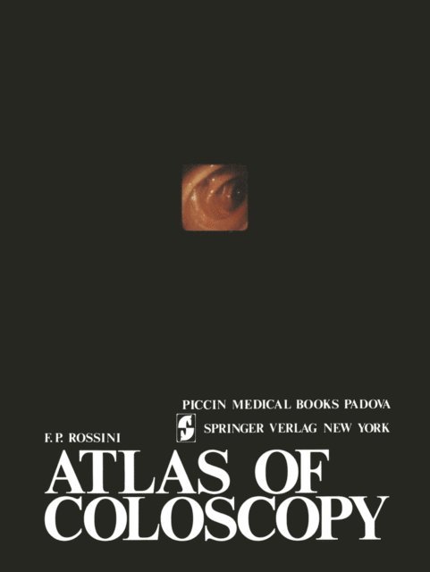 ROSSINI - Atlas of coloscopy, E-bok
