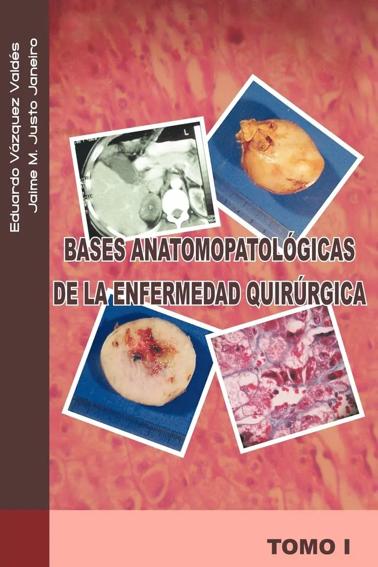 Jaime M Justo J, Eduardo V Zquez V, Eduardo Vazquez V - Bases Anatomopatologicas de La Enfermedad Quirurgica, Häftad. Tillgänglighet: Lägg i varukorg