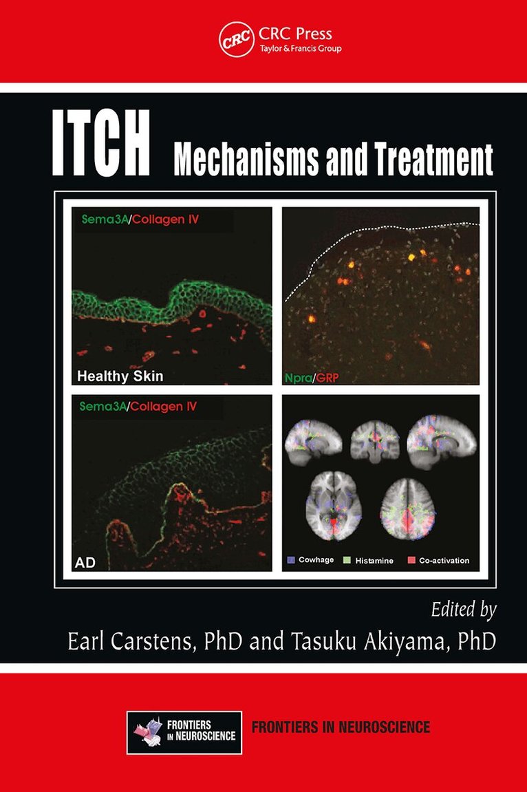 E. Carstens, Tasuku Akiyama - Itch, E-bok