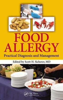 Scott H. Sicherer - Food Allergy, E-bok