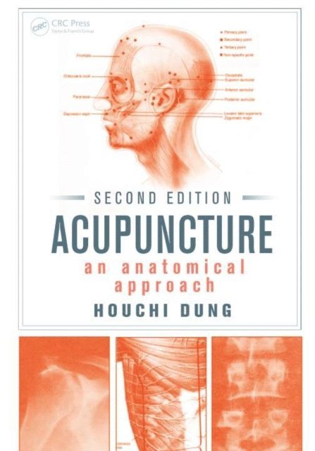 Indra K. Reddy, Houchi Dung - Acupuncture, E-bok