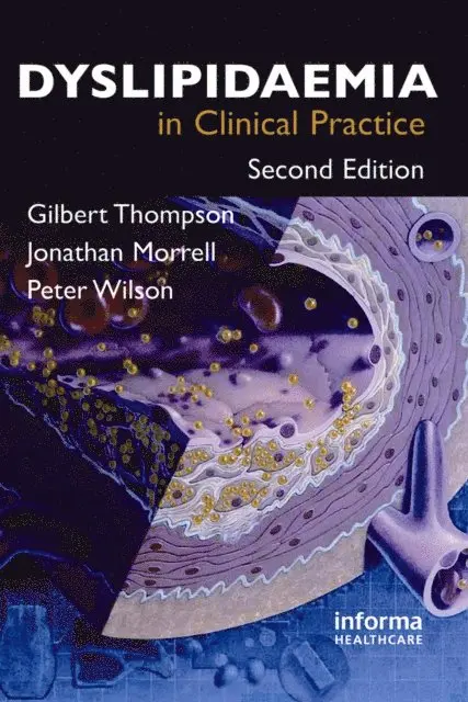Jonathan Morrell, Gilbert Thompson - Dyslipidaemia in Clinical Practice, E-bok. Tillgänglighet: Lägg i varukorg
