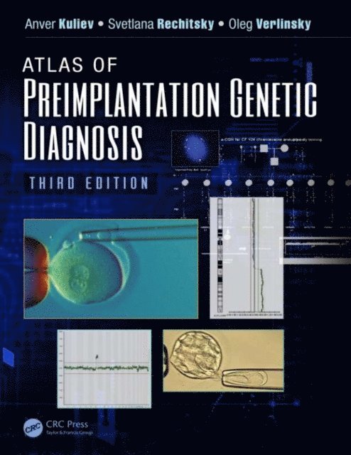 Oleg Verlinsky, Svetlana Rechitsky, Anver Kuliev - Atlas of Preimplantation Genetic Diagnosis, E-bok