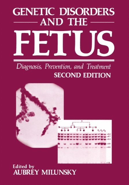 Aubrey Milunsky - Genetic Disorders and the Fetus, E-bok
