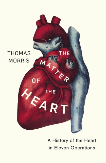 Thomas Morris - Matter of the Heart, E-bok