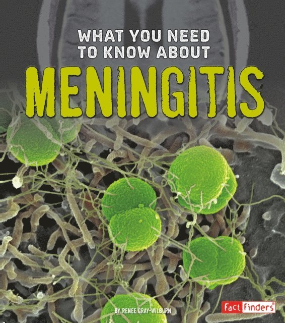 Renee Gray-Wilburn - What You Need to Know about Meningitis, E-bok