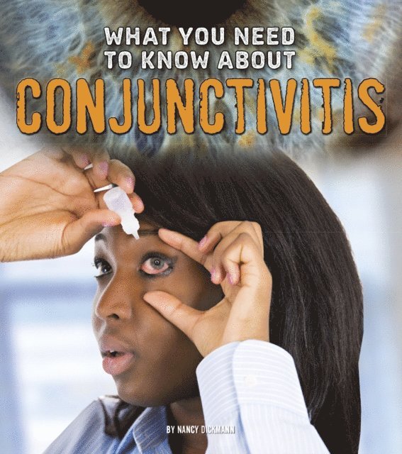 What You Need to Know about Conjunctivitis