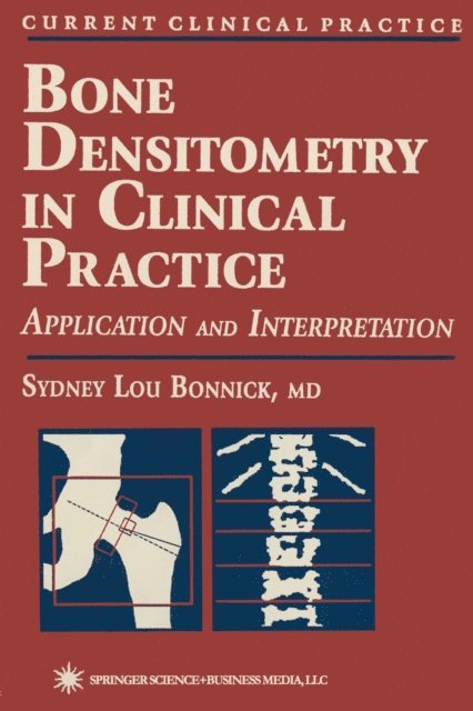 Sydney Lou Bonnick - Bone Densitometry in Clinical Practice, E-bok