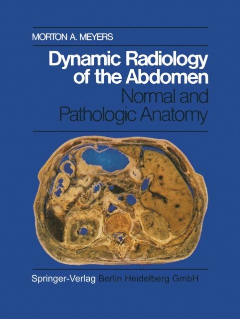 M.A. Meyers - Dynamic Radiology of the Abdomen, E-bok. Tillgänglighet: Lägg i varukorg
