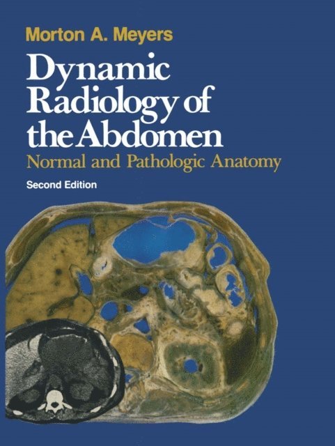 M.A. Meyers - Dynamic Radiology of the Abdomen, E-bok. Tillgänglighet: Lägg i varukorg