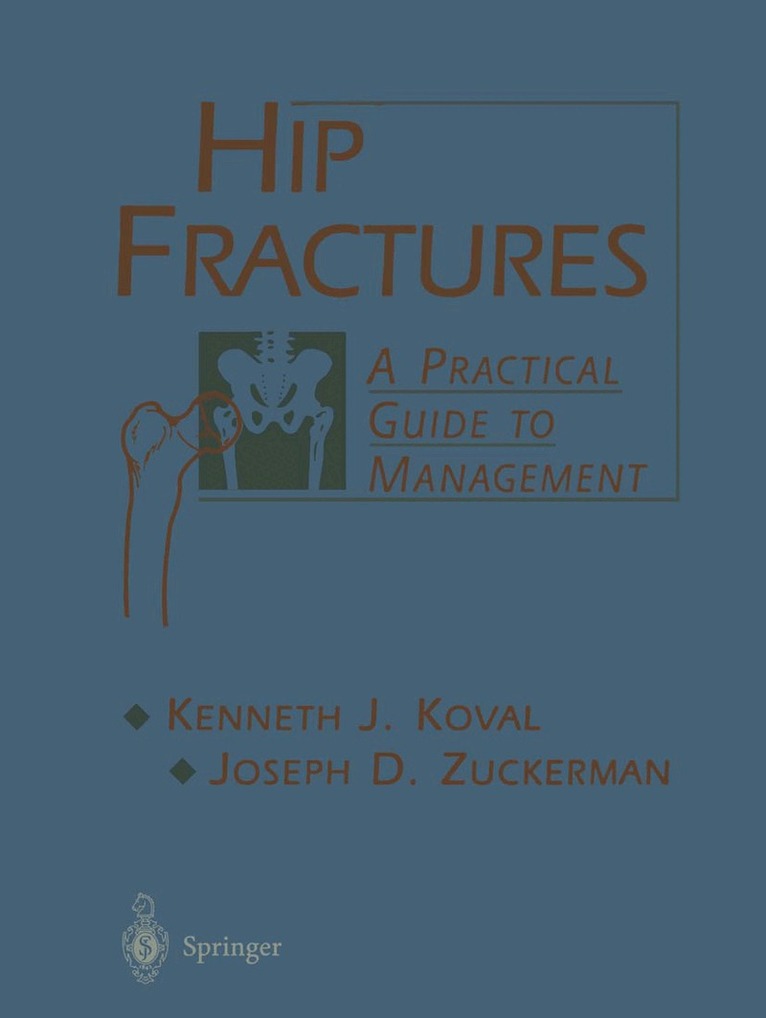 Kenneth Koval, Joseph Zuckerman - Hip Fractures, Häftad. Tillgänglighet: Lägg i varukorg