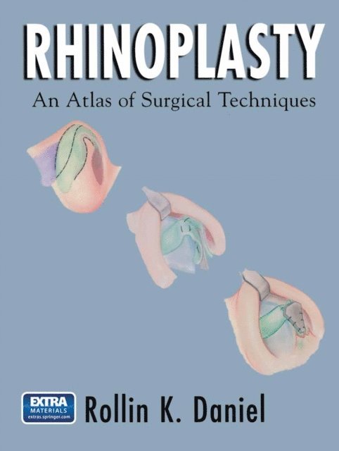 Rollin K. Daniel - Rhinoplasty, E-bok