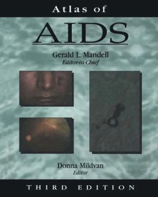Donna Mildvan, Gerald L. Mandell - Atlas of AIDS, E-bok. Tillgänglighet: Lägg i varukorg
