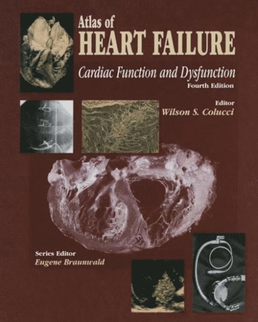 Wilson S. Colucci - Atlas of HEART FAILURE, E-bok