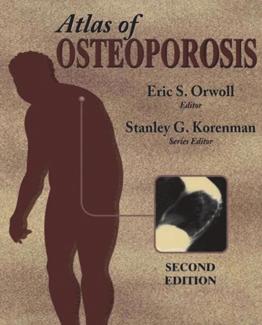 Stanley G. Korenman - Atlas of Osteoporosis, E-bok