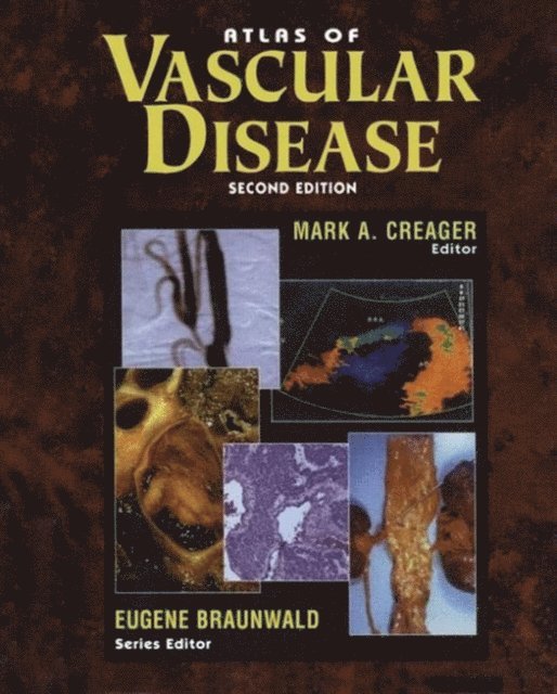 Eugene Braunwald, Mark A. Creager - Atlas of Vascular Disease, E-bok