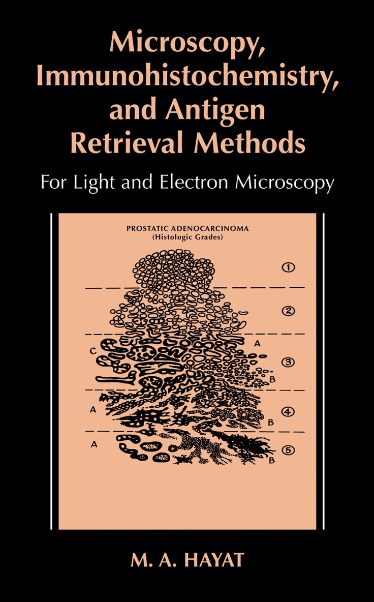 M.A. Hayat - Microscopy, Immunohistochemistry, and Antigen Retrieval Methods, Häftad. Tillgänglighet: Lägg i varukorg
