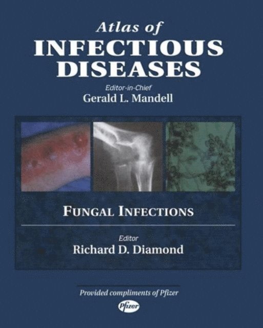 Richard D. Diamond - Atlas of Infectious Diseases, E-bok