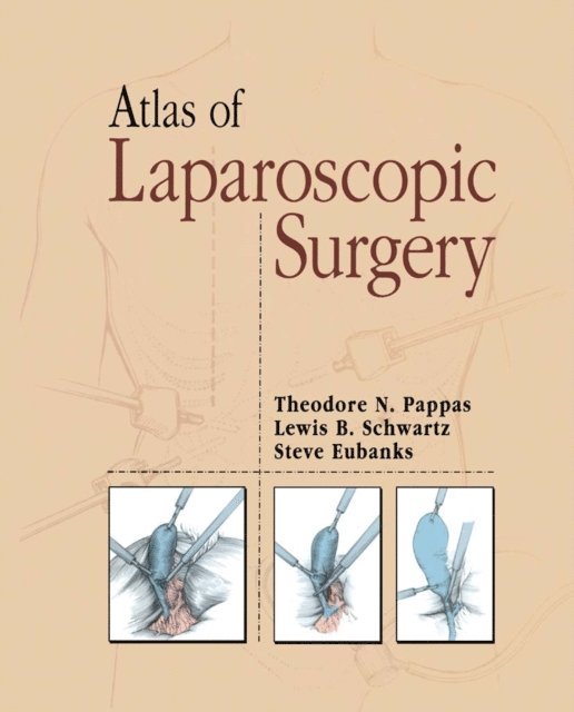 Michael Harnisch, Steve Eubanks, Lewis B. Schwartz, Theodore Pappas - Atlas of Laparoscopic Surgery, E-bok