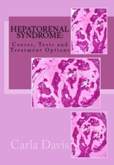 Carla Davis - Hepatorenal Syndrome: Causes, Tests, and Treatment Options, E-bok. Tillgänglighet: Lägg i varukorg