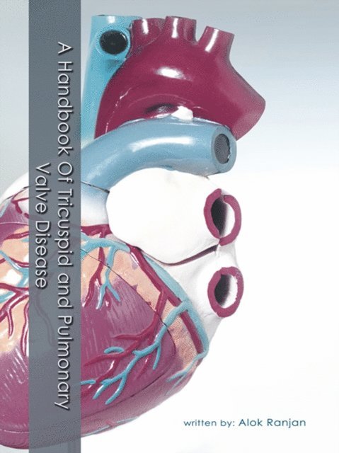 Alok Ranjan - Handbook of Tricuspid and Pulmonary Valve Disease, E-bok