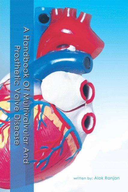 Alok Ranjan - Handbook of Multivalvular and Prosthetic Valve Disease, E-bok