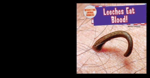 Leeches Eat Blood!