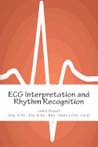 Peter Fletcher - ECG Interpretation and Rhythm Recognition, Häftad. Tillgänglighet: Lägg i varukorg