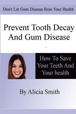 Alicia Smith - Prevent Tooth Decay and Gum Disease - How To Save Your Teeth And Your Health, Häftad