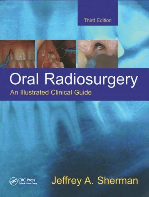 Jeffrey A. Sherman - Oral Radiosurgery, E-bok. Tillgänglighet: Lägg i varukorg
