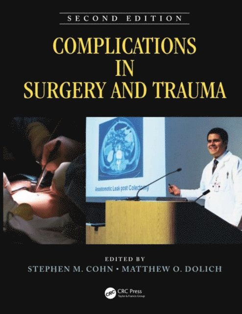Matthew Dolich, Stephen Cohn - Complications in Surgery and Trauma, E-bok