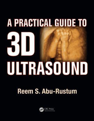 Reem S. Abu-Rustum - Practical Guide to 3D Ultrasound, Häftad. Tillgänglighet: Lägg i varukorg