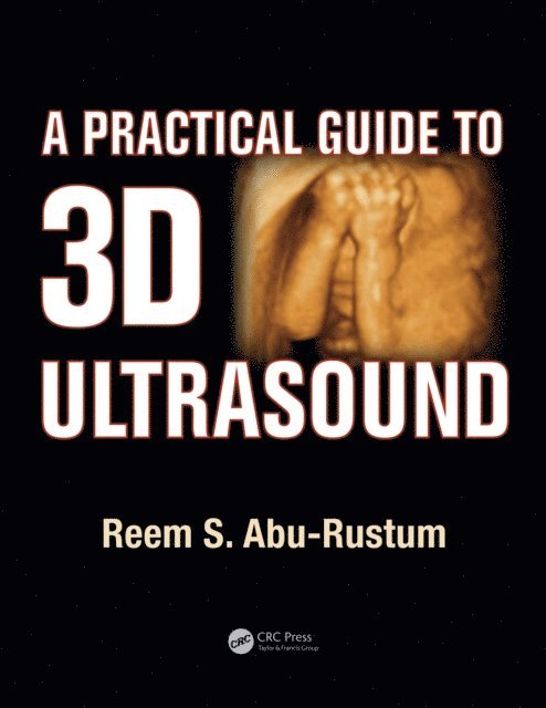 Reem S. Abu-Rustum - Practical Guide to 3D Ultrasound, E-bok. Tillgänglighet: Lägg i varukorg