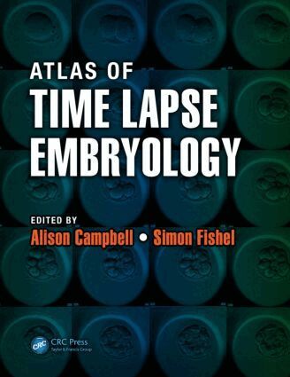 Alison Campbell, Simon Fishel - Atlas of Time Lapse Embryology, Häftad. Tillgänglighet: Lägg i varukorg