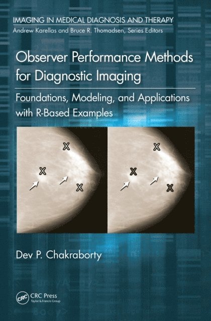 Dev P. Chakraborty - Observer Performance Methods for Diagnostic Imaging, E-bok
