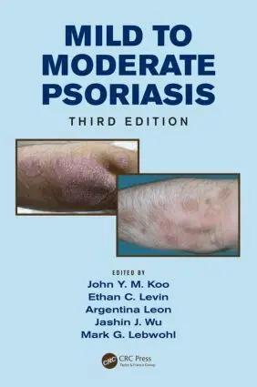 John Koo, Ethan Levin, Argentina Leon, Jashin Wu, Mark Lebwohl - Mild to Moderate Psoriasis, Inbunden