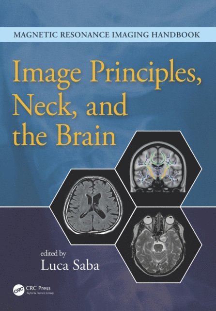 Luca Saba - Image Principles, Neck, and the Brain, E-bok