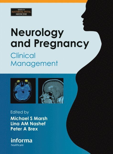 Peter Brex, Lina Nashef, Michael S. Marsh - Neurology and Pregnancy, E-bok