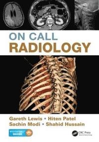 On Call Radiology