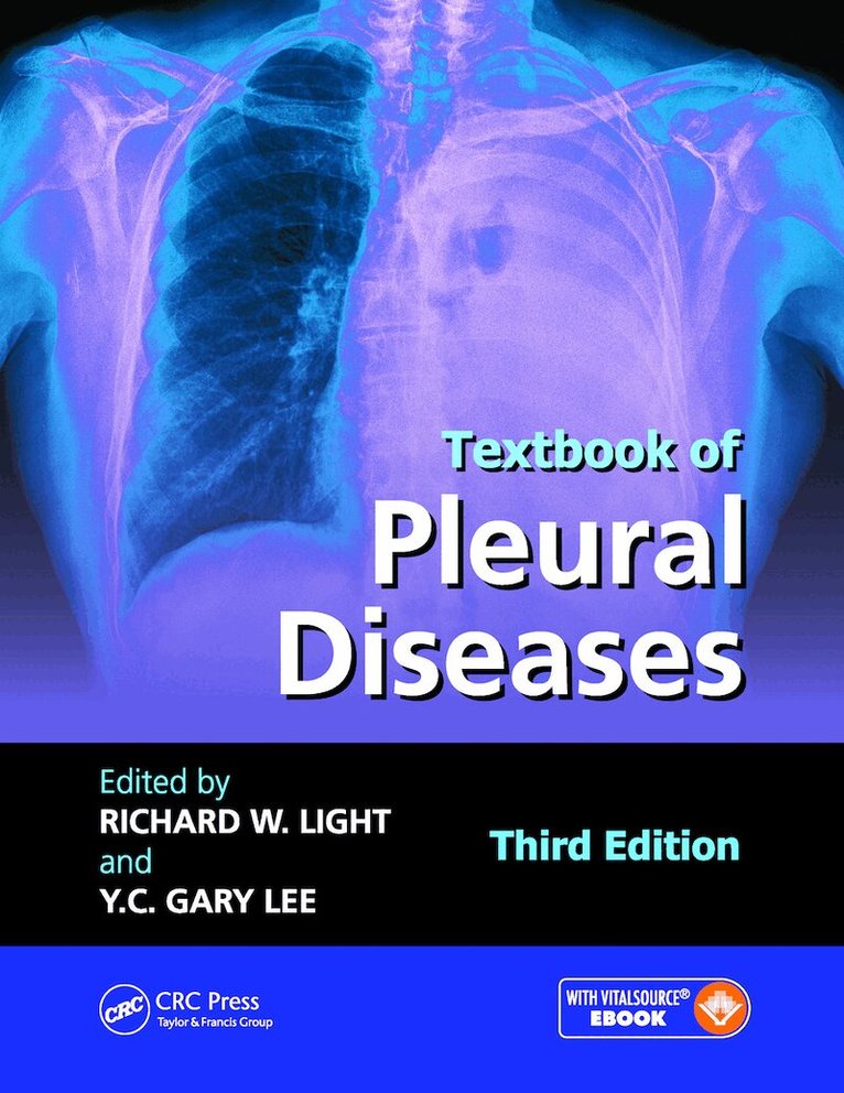 Richard W. Light, Y C Gary Lee - Textbook of Pleural Diseases, E-bok